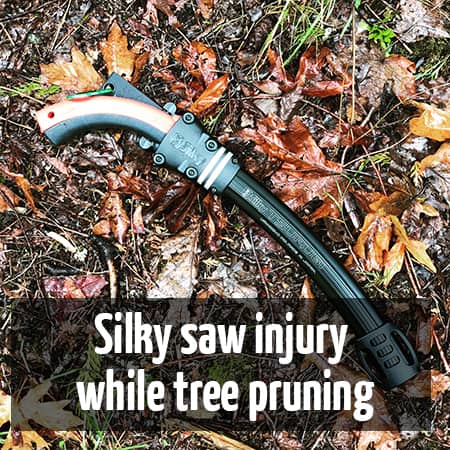 Silky saw injury